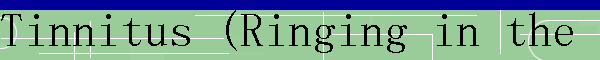 Tinnitus (Ringing in the ears)